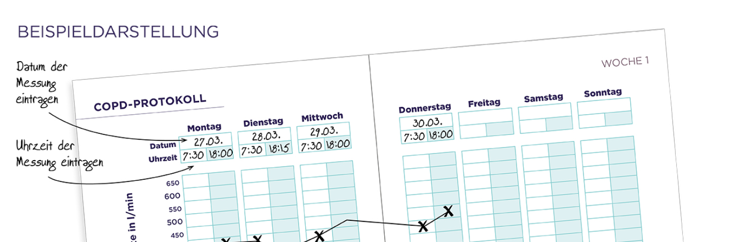 COPD-Tagebuch: Ihre Peak-Flow-Werte & Symptome im Blick